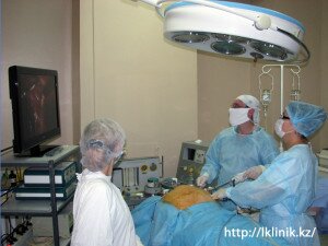 Лапароскопическая герниопластика послеоперационной грыжи